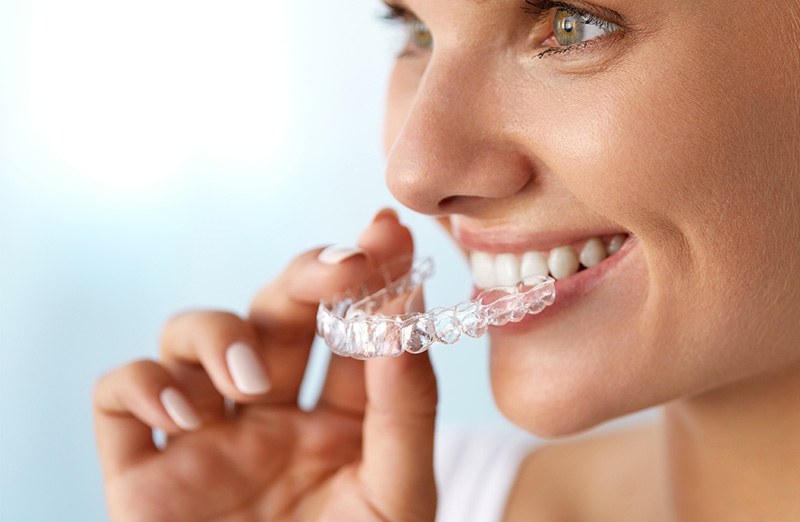 Teeth Whitening