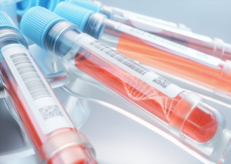 Hormone Tests