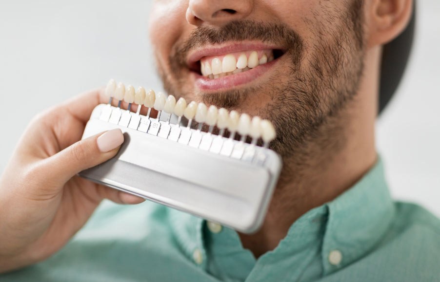 A dentist matching a man's teeth to the shade guide