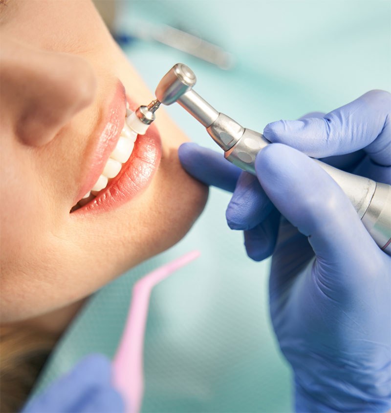 A dentist polishing a patient's teeth