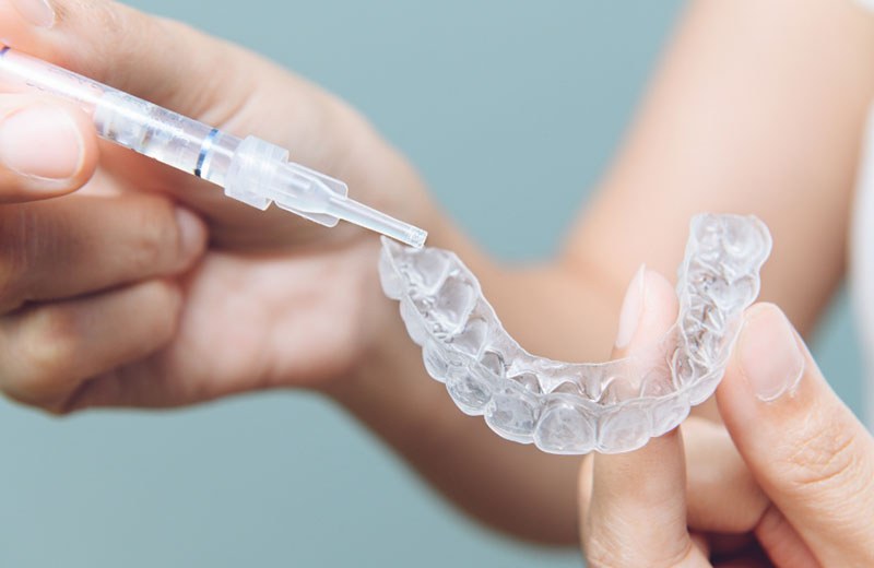 Clear Aligners