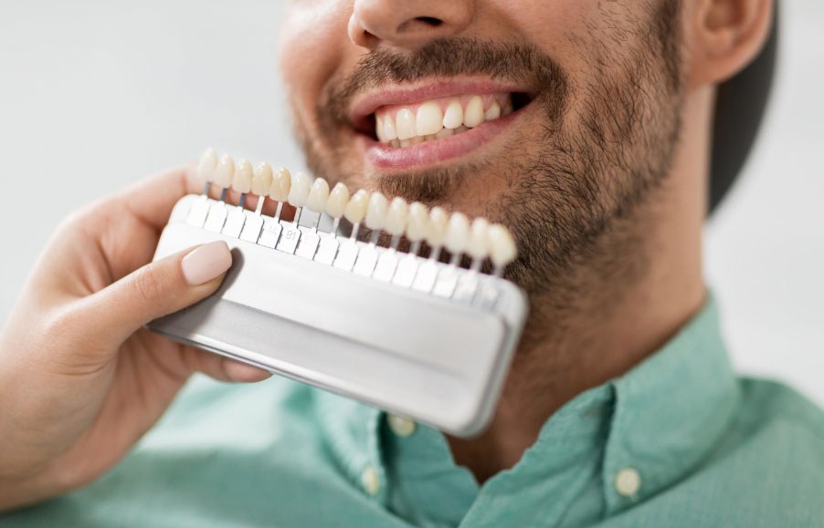 Teeth Whitening