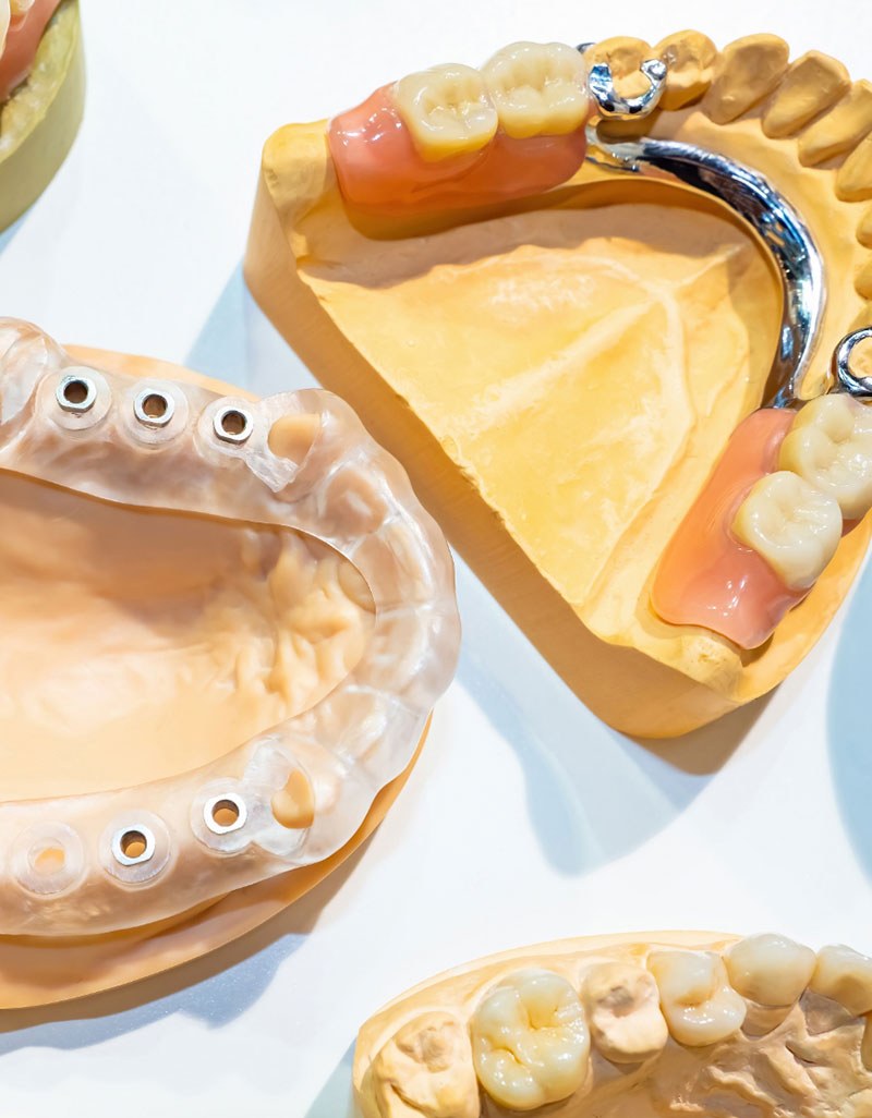 A dental model with braces