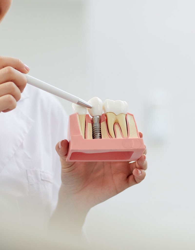 A model of the teeth and jaw
