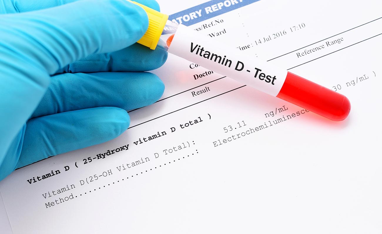 Your Lab Results, Explained