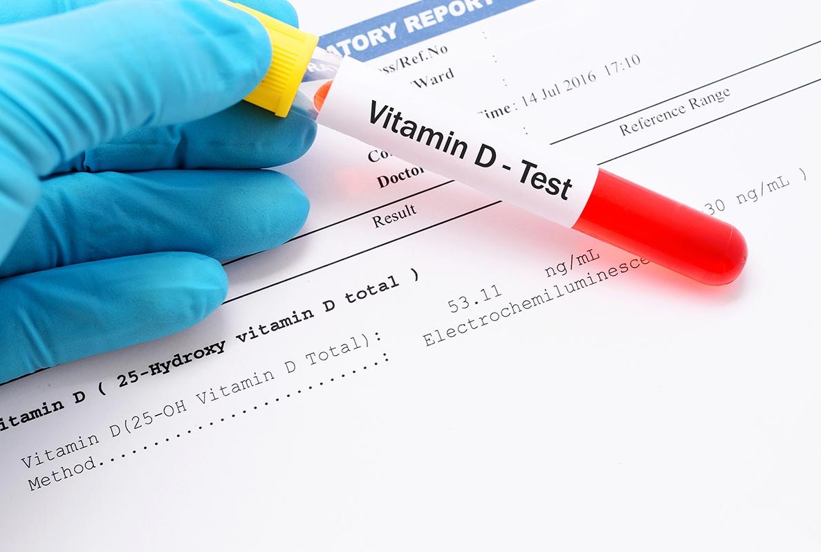 How Much Vitamin D Do You Need In Winter?
