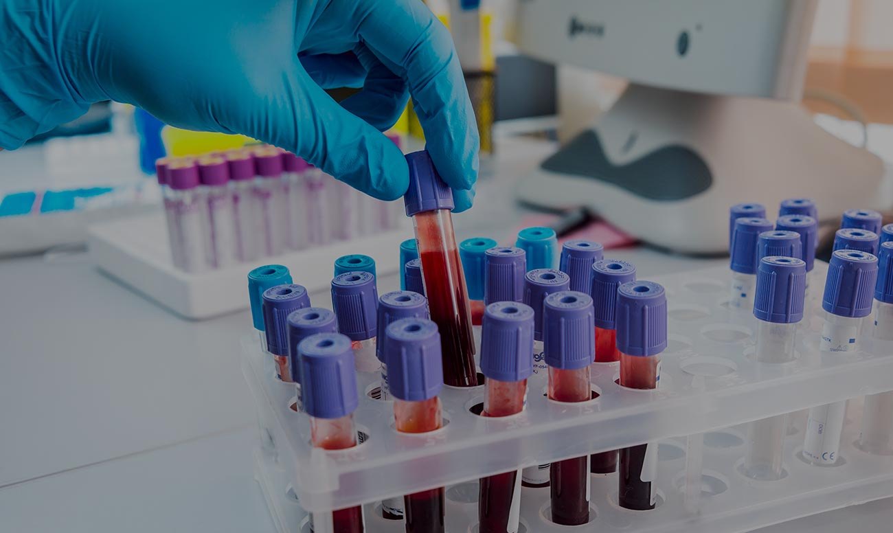 What Your Cholesterol Numbers Mean