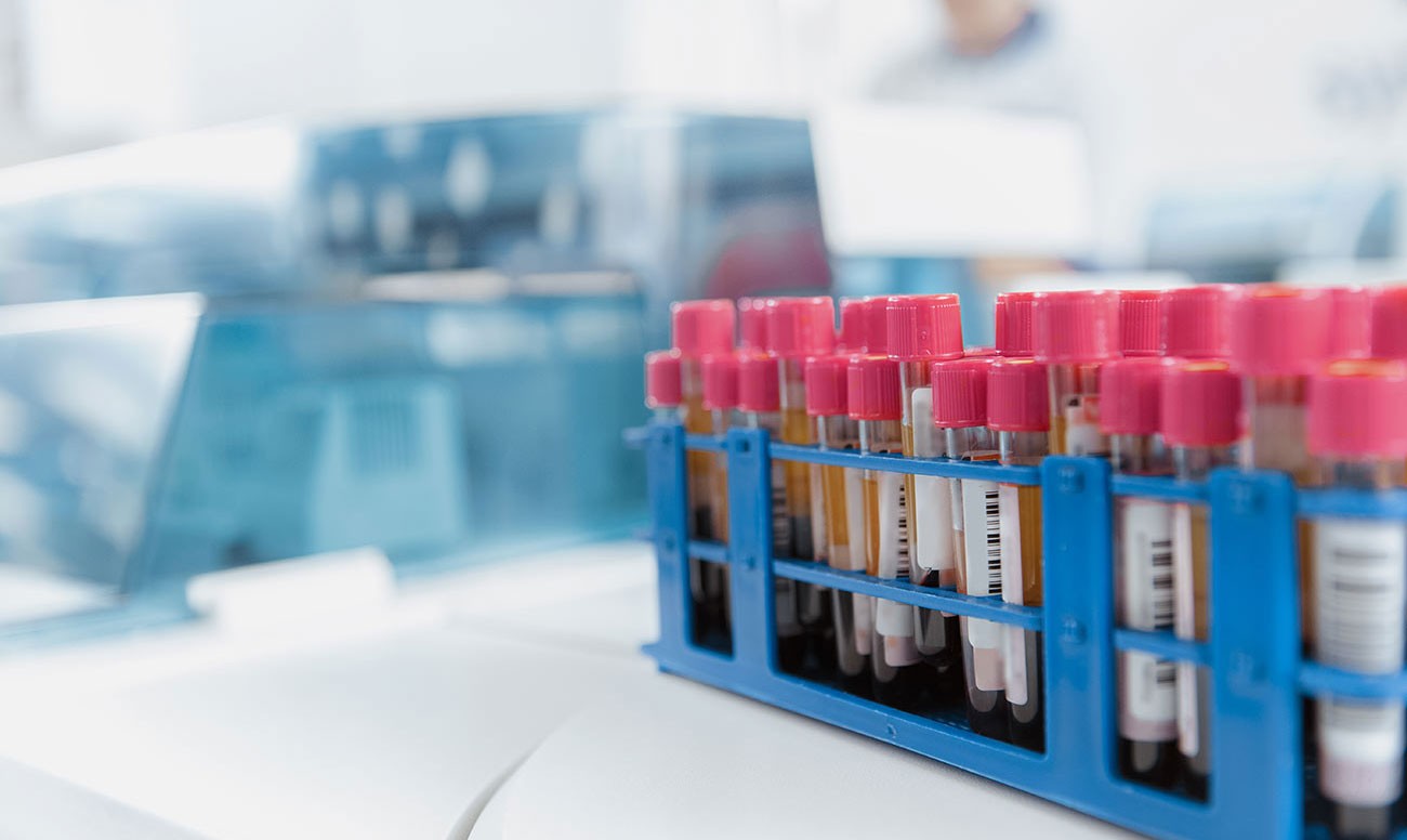 What Your Blood Test Results Mean
