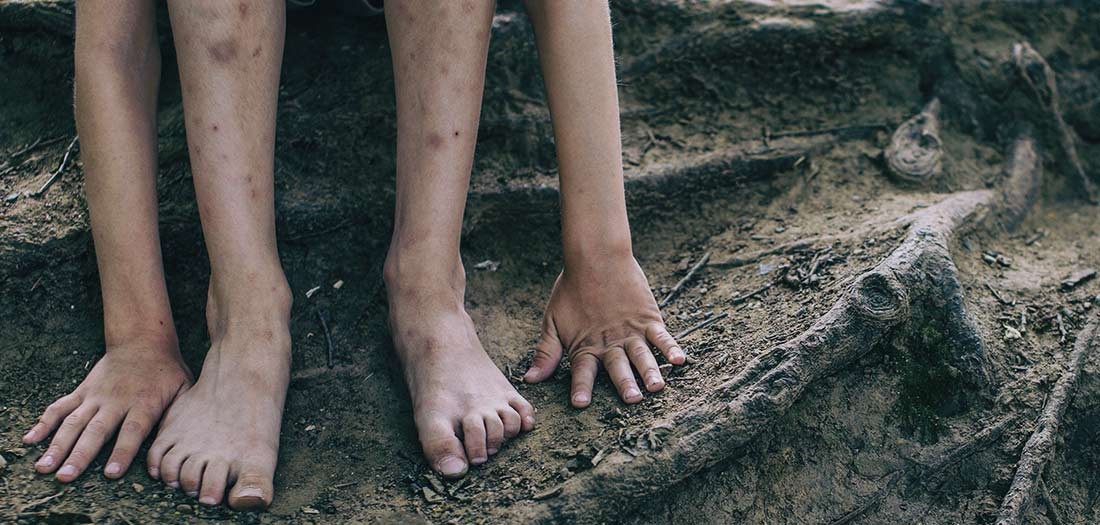 Bare feet on tree roots